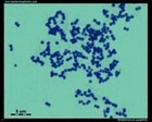 Streptococcus pyogenes microscopy